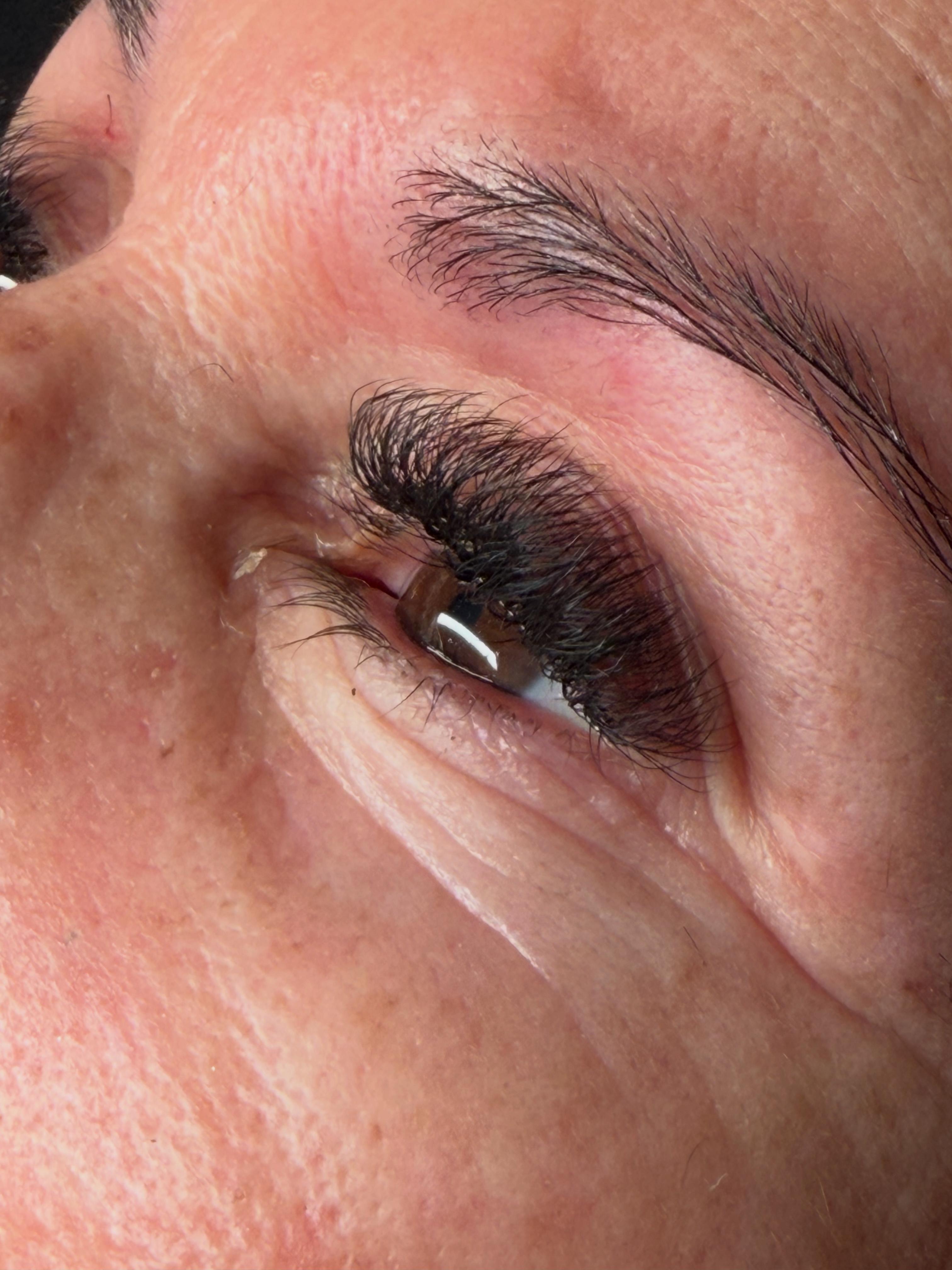 Glow Face Beauty result