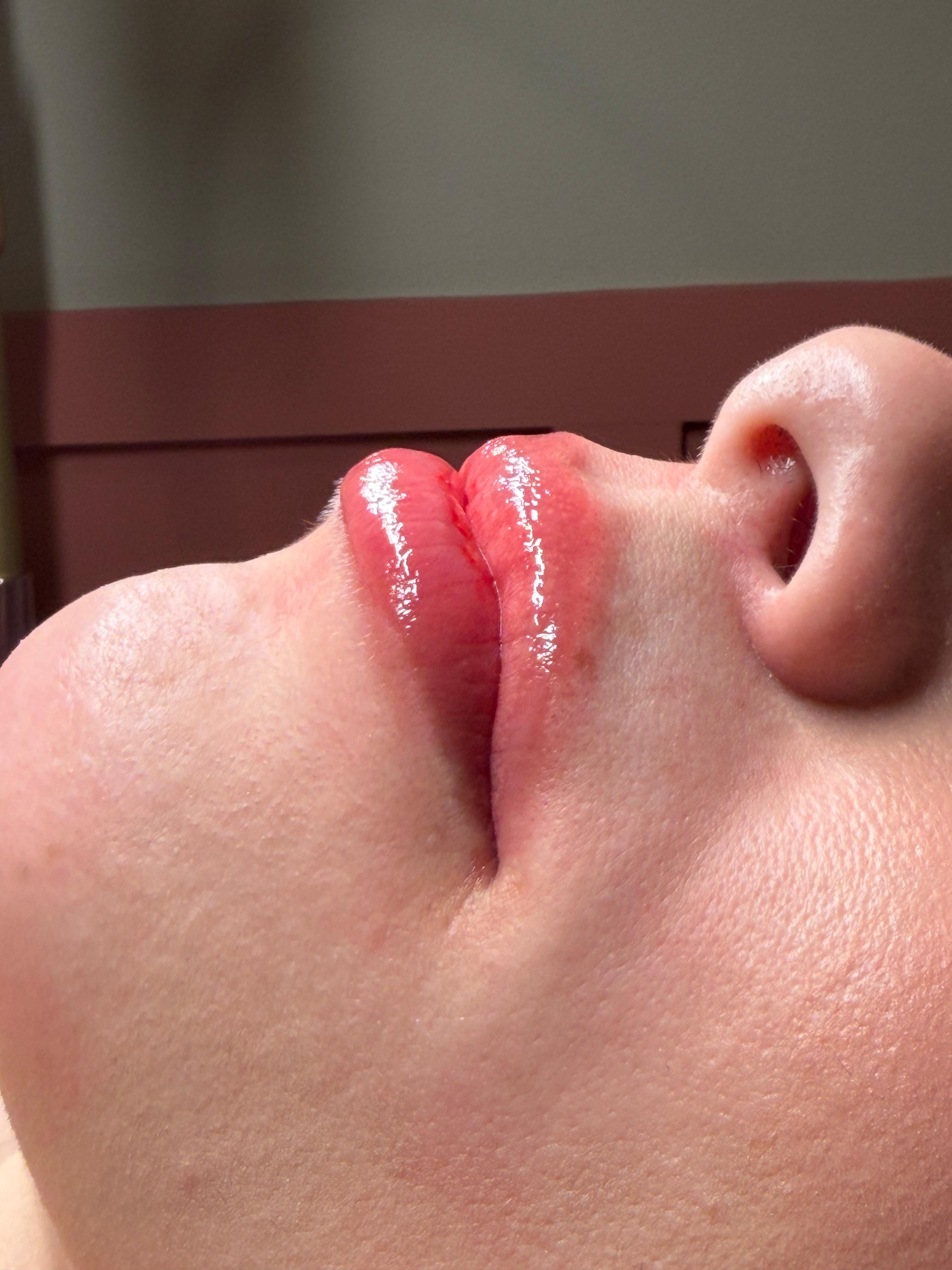 Glow Face Beauty result